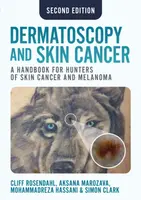 Dermatoscopy and Skin Cancer, second edition - Simon Clark, Aksana Marozava, Mohammadreza Hassani, Cliff Rosendahl