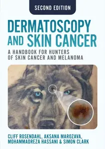 Dermatoscopy and Skin Cancer, second edition - Simon Clark, Aksana Marozava, Mohammadreza Hassani, Cliff Rosendahl