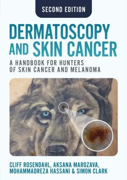 Dermatoscopy and Skin Cancer, second edition - Simon Clark, Aksana Marozava, Mohammadreza Hassani, Cliff Rosendahl