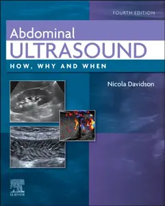 Abdominal Ultrasound