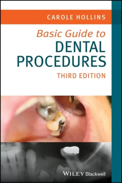 Basic Guide to Dental Procedures, 3rd Edition - Carole Hollins
