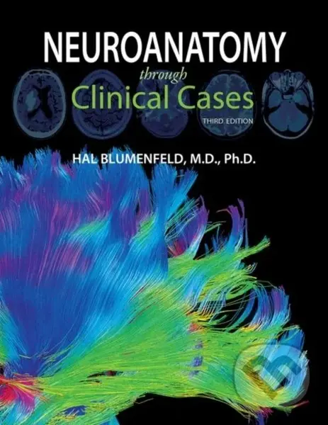 Neuroanatomy through Clinical Cases - Hal Blumenfeld
