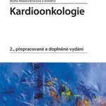 Kardioonkologie - Beata Mladosievičová - e-kniha