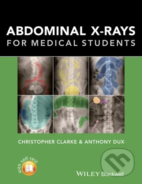 Abdominal X-rays for Medical Students - Anthony Dux, Christopher Clarke,Abdominal X-rays for Medical Students - Anthony Dux, Christopher Clarke