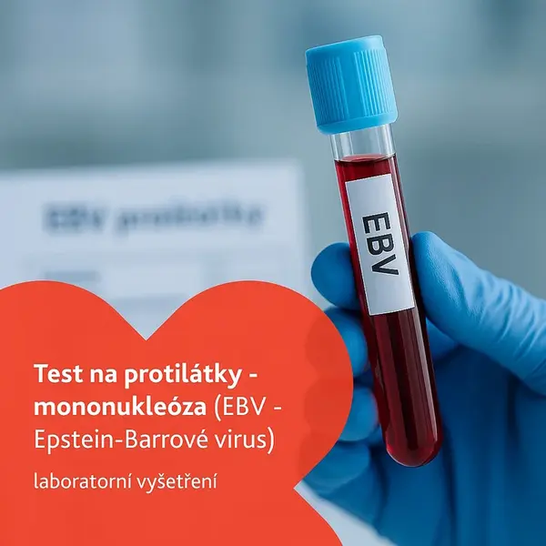 Test na protilátky - mononukleóza laboratorní vyšetření