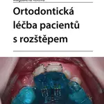 Kniha: Ortodontická léčba pacientů s rozštěpem od Koťová Magdalena