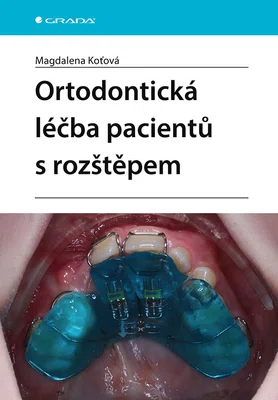 Kniha: Ortodontická léčba pacientů s rozštěpem od Koťová Magdalena