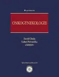 Onkogynekologie - David Cibula, Luboš Petruželka - e-kniha