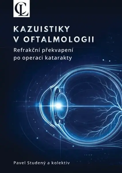 Kazuistiky v oftalmologii - Studený Pavel