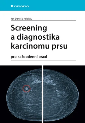E-kniha: Screening a diagnostika karcinomu prsu od Daneš Jan
