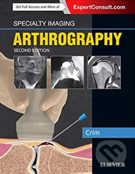 Specialty Imaging: Arthrography - Julia R. Crim - kniha z kategorie Medicína