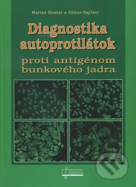 Diagnostika autoprotilátok (Proti antigénom bunkového jadra) - kniha z kategorie Imunologie, virologie a epidemiologie