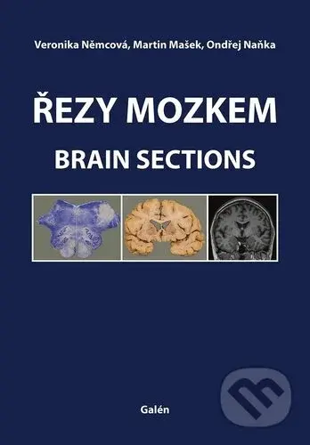 Řezy mozkem (Atlas makroskopických, mikroskopických a MRI řezů) - kniha z kategorie Vysoké školy