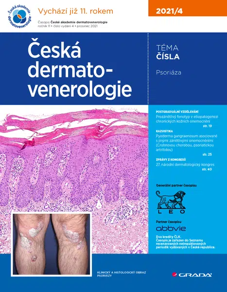 Česká dermatovenerologie 2021/4, Hercogová Třešňák Jana