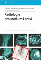 Radiologie pro studium i praxi - Zdeněk Seidl, Manuela Vaněčková, Andrea Burgetová, Eva Hoffmannová, Martin Mašek, Tomáš Viták