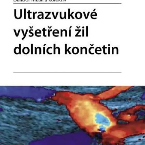 Ultrazvukové vyšetření žil dolních končetin - Dalibor Musil - e-kniha