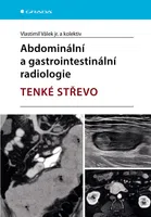 Kniha: Abdominální a gastrointestinální radiologie od Válek jr. Vlastimil
