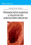 E-kniha: Onemocnění karotid a velkých cév aortálního oblouku od Čertík Bohuslav