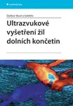 E-kniha: Ultrazvukové vyšetření žil dolních končetin od kolektiv