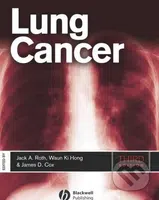 Lung Cancer - Jack A. Roth, James D. Cox, Waun Ki Hong - kniha z kategorie Odborné a naučné