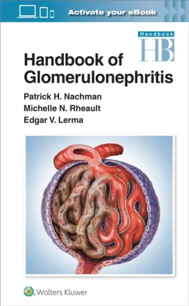 Handbook of Glomerulonephritis - Edgar Lerma, Patrick Henry Nachman, Michelle Rheault