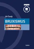 Bruxismus - Jiří Šedý - e-kniha