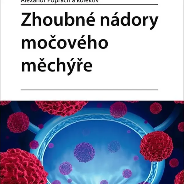 Zhoubné nádory močového měchýře