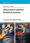 Ultrazvukové vyšetření žil dolních končetin - Dalibor Musil - e-kniha