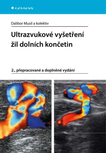 Ultrazvukové vyšetření žil dolních končetin - Dalibor Musil - e-kniha