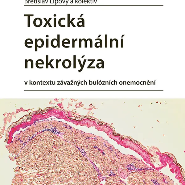 E-kniha: Toxická epidermální nekrolýza od Lipový Břetislav
