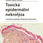 Kniha: Toxická epidermální nekrolýza od Lipový Břetislav