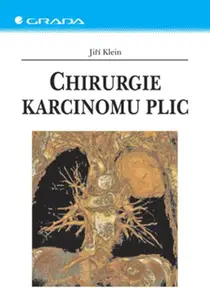E-kniha: Chirurgie karcinomu plic od Klein Jiří