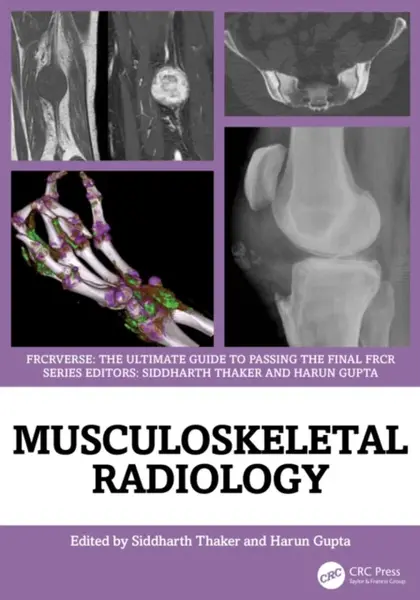 Musculoskeletal Radiology