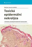Toxická epidermální nekrolýza - kolektiv autorů, Břetislav Lipový - e-kniha