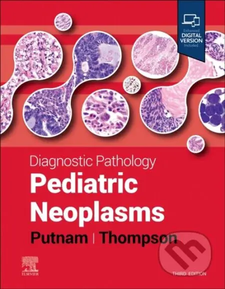 Diagnostic Pathology: Pediatric Neoplasms - Angelica R. Putnam, Karen S. Thompson - kniha z kategorie Onkologie