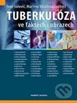 Tuberkulóza ve faktech i obrazech - Ivan Solovič - kniha z kategorie Medicína