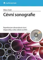 Kniha: Cévní sonografie od Cholt Milan
