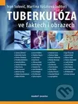 Tuberkulóza ve faktech i obrazech - Ivan Solovič