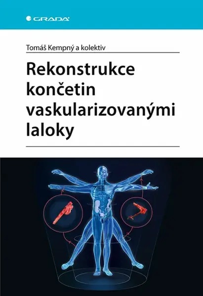 Rekonstrukce končetin vaskularizovanými laloky - kolektiv autorů, Tomáš Kempný