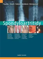 Spondyloartritidy - Karel Pavelka, kolektiv autorů, Jarmila Heissigerová, Markéta Hušáková, Ladislav Šenolt, Liliana Šedová