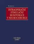 Intraoperační stimulační monitorace v neurochirurgii - Lubor Stejskal - e-kniha