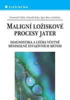 E-kniha: Maligní ložiskové procesy jater od Válek Vlastimil