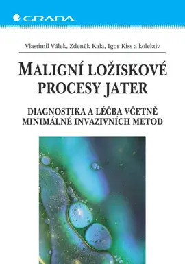 E-kniha: Maligní ložiskové procesy jater od Válek Vlastimil
