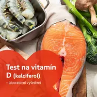 Test na vitamín D (kalciferol) - laboratorní vyšetření