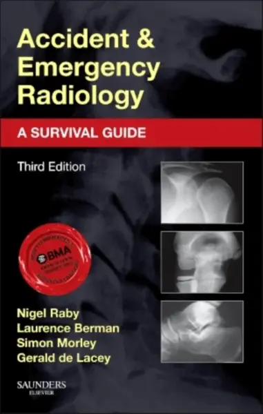 Accident and Emergency Radiology: A Survival Guide - Gerald, MA, FRCR  de Lacey, Simon, FRCR  Morley, Nigel, FRCR  Raby, Laurence, MB, BS, FRCP, FRCR 