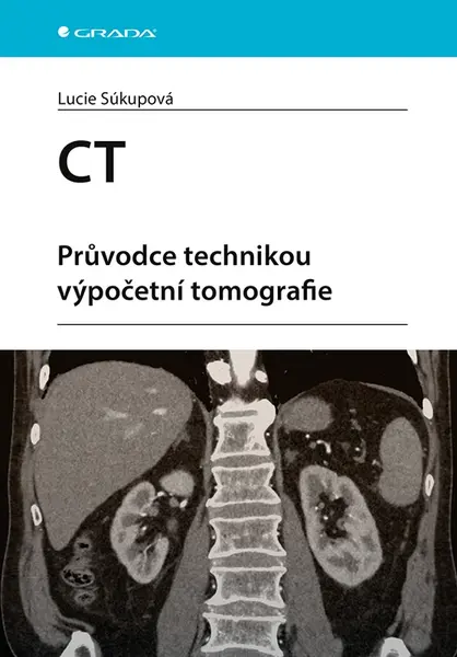 Kniha: CT - Průvodce technikou výpočetní tomografie od Súkupová Lucie