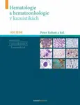 Hematologie a hemootonkologie v kazuistikách - Peter Rohoň