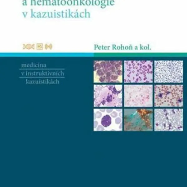 Hematologie a hemootonkologie v kazuistikách - Peter Rohoň