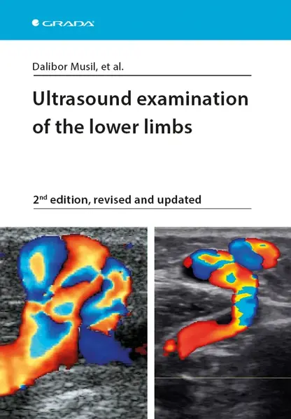 E-kniha: Ultrasound examination of the lower limbs od Musil Dalibor