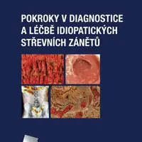 Pokroky v diagnostice a léčbě idiopatických střevních zánětů - Milan Lukáš